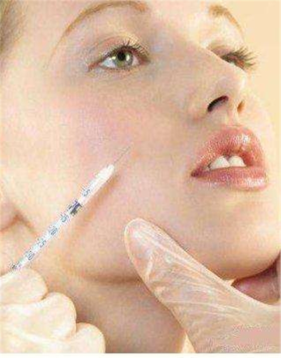 20170316085843184.jpg 20170316085843184.jpg